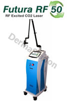 The Carbon Dioxide (C02)