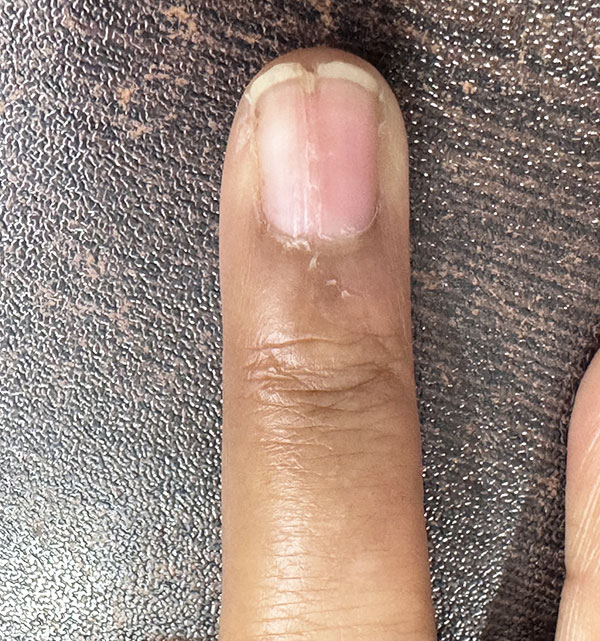 After 6 Months