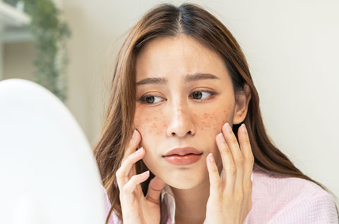 Pigmentation Treatment in Delhi